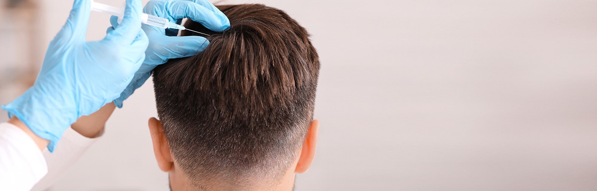 Stimuler la pousse des cheveux par injections PRP à Grenoble