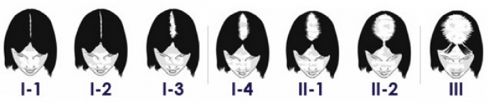 Classification de LUDWIG