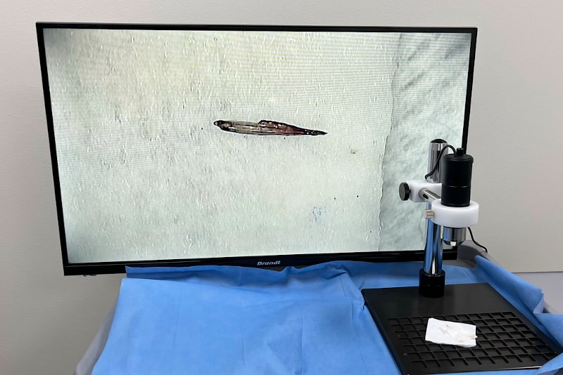 Vérification des greffons au microscope