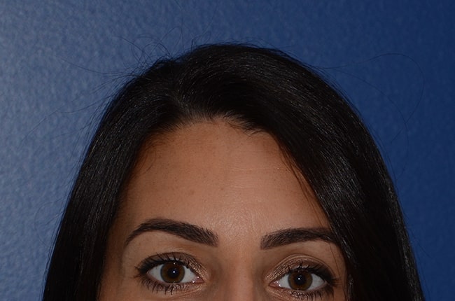 Femme vue de face