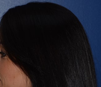 Femme profil gauche