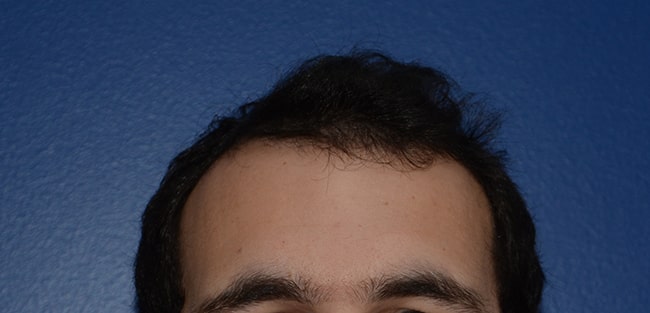 Homme vue de face