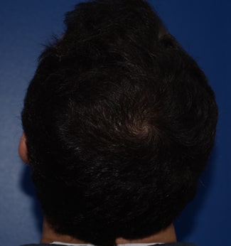 Homme vue arrière