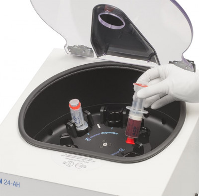 Centrifugation du prélèvement